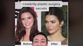 Voices: In defence of celebrities and plastic surgery