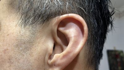6旬男突耳鳴聽不清楚 醫：突發性聽力損失快就醫 - 自由健康網