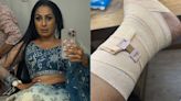 'Hurt My Rib, Twisted Ankle': Kashmera Shah Suffers Injury After Falling On Sets Of Laughter Chefs, Shares Photos