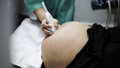 DGS faz recomendações aos profissionais de saúde sobre efeito do parvovírus em grávidas