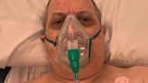 DWP tells terminally-ill man with oxygen mask to go to job appointments