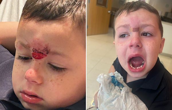 Pennsylvania dad demands answers after son, 5, has teeth knocked out in bloody assault at school, lawyer says