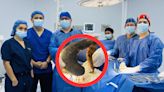 Cirujanos en Ecuador extraen bola de pelos gigante del estómago de una mujer