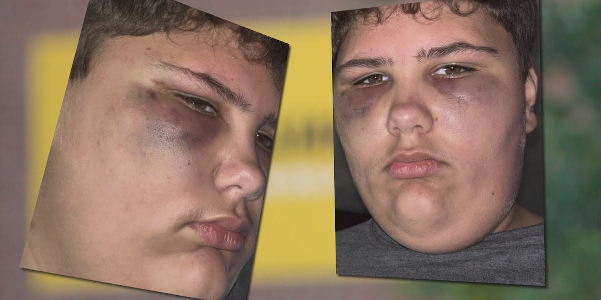 Bus driver no longer driving after student assaulted, beaten with belt during fight on bus