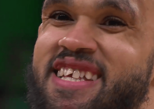 Celtics' Derrick White flashed a big grin after chipping his tooth on the NBA Finals court