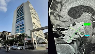 Mumbai Medical Miracle: Docs At Wockhardt Hospital Remove Over 7 Centimeters Long & Rare Non-Cancerous Tumour From...