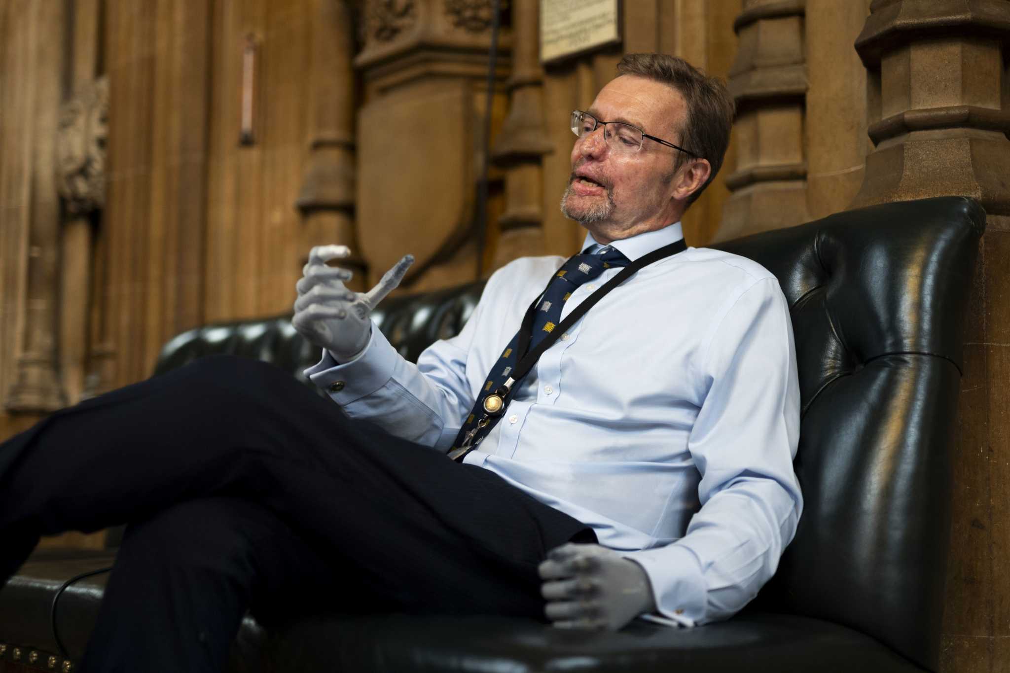 UK lawmaker who wanted to be known as the 'bionic MP' says he has decided not to run for re-election