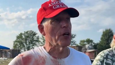 Blood-soaked ER doctor shares moment he performed CPR on Trump rally victim