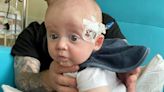 Tot, 2, born with one 'very large leg' that's grown 'uncontrollably' ever since