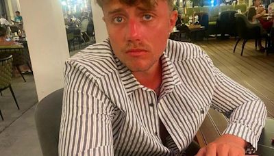 Embarrassed Roman Kemp unveils sunburnt face and issues warning to fans