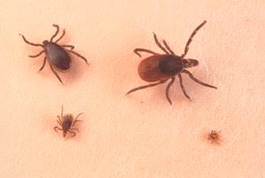 First confirmed case of rare, tick-borne Powassan virus reported in Mass. town