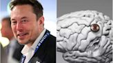 Neuralink volverá a implantar un chip cerebral: estos son los “superpoderes” que anunció Elon Musk - La Tercera