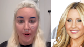 Amanda Bynes Reveals Drastic Plastic Surgery Removing ‘Skin Folds’ From Eyes