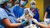 How a team of Tampa doctors helped deliver baby orangutan at Busch Gardens