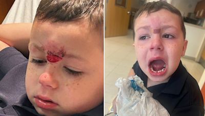 Pennsylvania dad demands answers after son, 5, has teeth knocked out in bloody assault at school, lawyer says