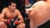 Igor Severino handed a nine-month suspension for biting opponent at UFC Fight Night event | BJPenn.com