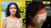 'I can't see': Jasmin Bhasin says she damaged her corneas after wearing lenses, undergoes treatment