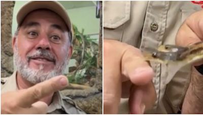 US Zookeeper Bitten By Both Heads Of Rare Two-Headed Snake