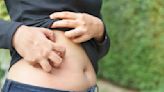 Why You May Have an Itchy Stomach and What to Do About It