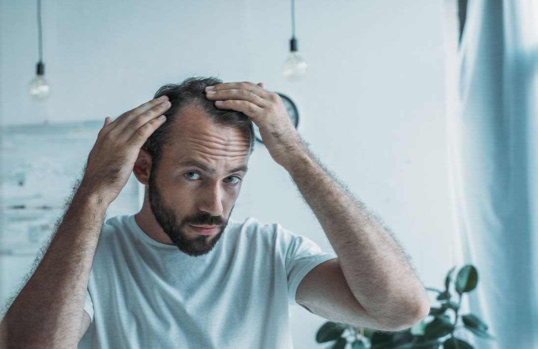 What Are the Side Effects of Topical Finasteride?