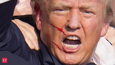 Donald Trump assassination attempt: Where are the stitches? Where are the scars?" Know in detail.