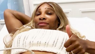 Serena Williams Reveals Tummy-Tightening Procedure but Says 'I Will Always Love My Birthing Scars'