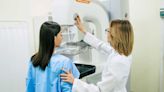 Many women still face barriers to getting regular mammograms, CDC study finds