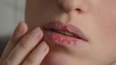 Cómo evitar la resequedad de los labios por el frío