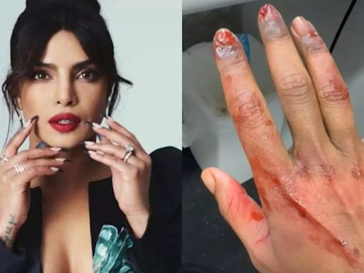 Priyanka Chopra Shocks Fans With Clip Of Injured Hand From The Bluff Sets, But There Is A Twist