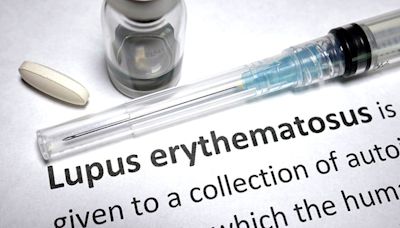 Multiple Investigational Approaches Show Promise for Lupus