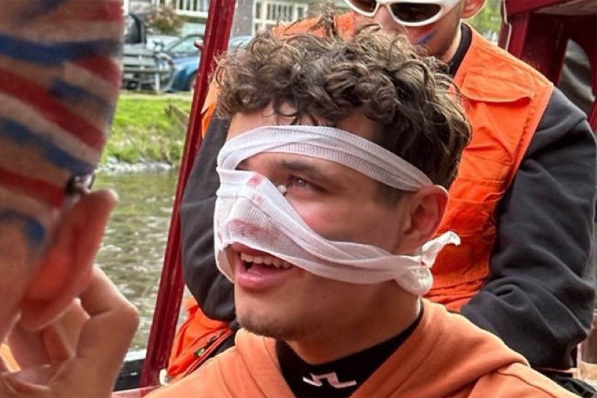 Lando Norris suffers nasty facial injury while partying in Amsterdam before Miami Grand Prix