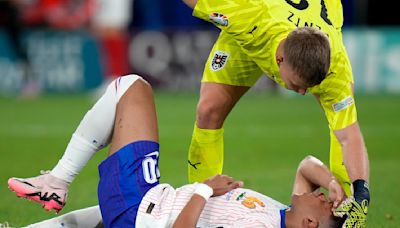 Kylian Mbappé due for tests on his broken nose as France gets 'positive' news on the striker