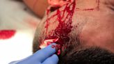 Cub Swanson shares image of ‘cut artery’ in Rafa Garcia’s bloodbath win at UFC Fight Night 216