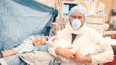 Mono mono twins success story: Morning sickness was symptom of rare twin pregnancy