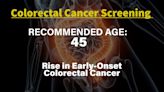 Your Health: What to know about early-onset colorectal cancer