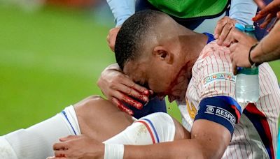 Kylian Mbappé sufre una fractura de nariz, pero se descarta la operación