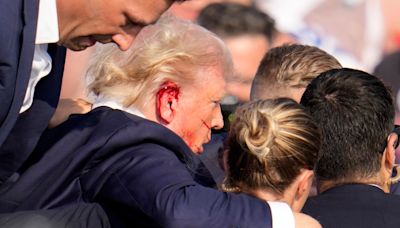 FBI questions whether Trump’s ear was directly hit by bullet