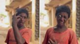 Watch: Boy Makes His Eye Come Out From The Socket - News18