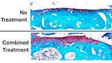 Parathyroid hormone treatment helps slow development of osteoporosis, researchers find