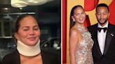 Chrissy Teigen Says Recent Neck Injury Isn't Why She and John Legend Skipped 2024 Met Gala