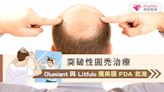 突破性圓禿治療：Olumiant與Litfulo獲美國FDA批准