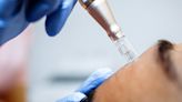 CDC describes first known cases of HIV transmitted via cosmetic injections