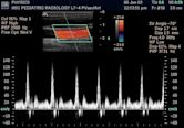 Doppler ultrasonography