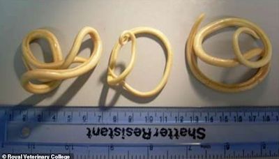 Chilling footage shows giant parasitic WORMS wiggling in the gut