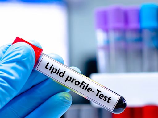 Gift Yourself a Lipid Profile Test Every Birthday or Anniversary and Learn to Read the Results | Health Matters - News18