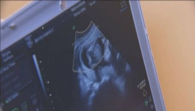 Florida law preventing abortions after 6 weeks of pregnancy goes into effect