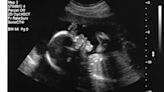 GE Ultrasound Gear Riddled With Bugs, Open to Ransomware & Data Theft