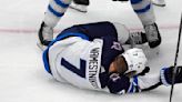 Jets forward Namestnikov is taken to the hospital after a puck hit him in the face