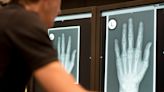 An AI bot scored nearly as well as doctors on a radiology exam — but it's not ready to replace humans yet