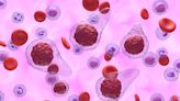 GSK’s Omjjara gains approval in Japan for myelofibrosis treatment